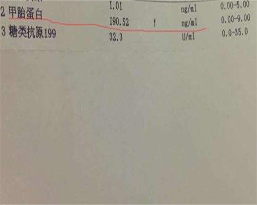 试管代生收费-睡觉左侧睡好还是右侧好