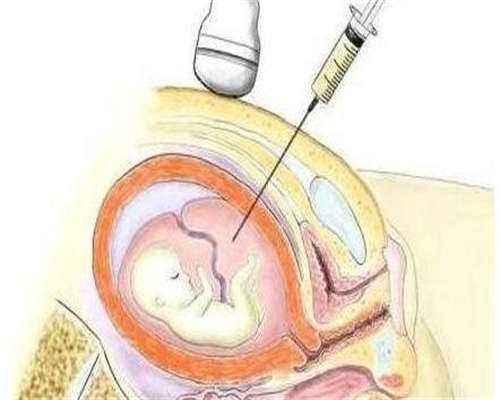子宫正常厚度一般是多少?正常子宫内膜厚度多少正常值是多少