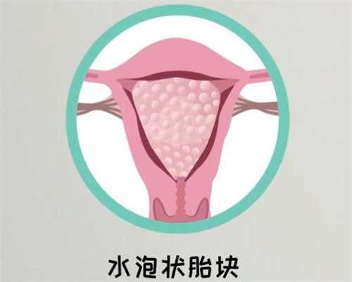 胎停后等多久才可以做试管?