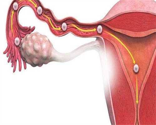 试管代生群-喝咖啡会影响试管移植效果嘛？喝咖啡会不会影响移植？