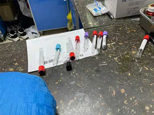 帮人代生费用-自然周期排卵几天后移植？自然周期怎么定移植日？